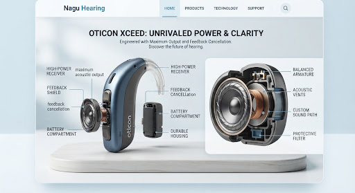 Heavy-duty powerful Oticon Xceed hearing aid engineered with maximum acoustic output and feedback cancellation casing displayed with detailed speaker components.